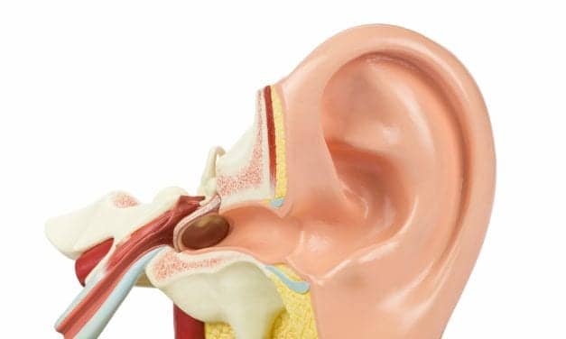 3-D Printed Prosthetic Replacements for Damaged Middle Ear May Improve Current Surgical Procedure