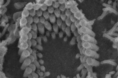 Researchers Close In on Mystery Channel Crucial for Hearing