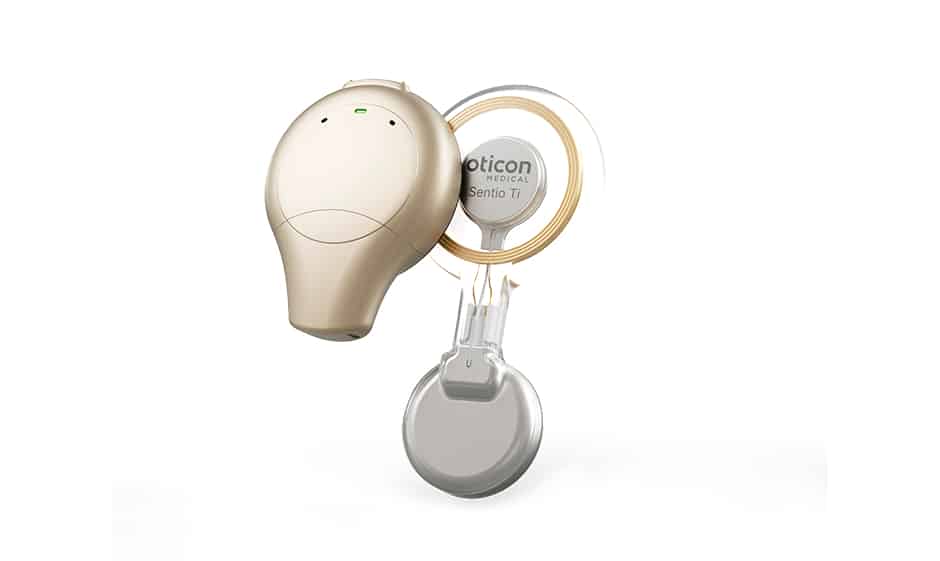 Oticon’s Sentio System Gets U.S. FDA Clearance